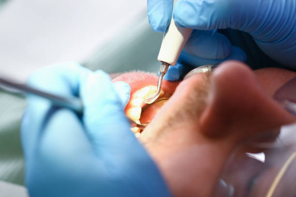 Best Emergency Care for Gum Disease in Linden, MI